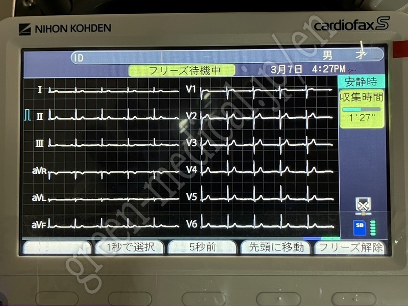 12.〇心電計