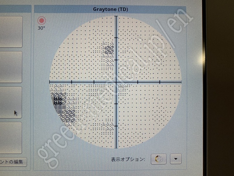 12.〇 自動視野計