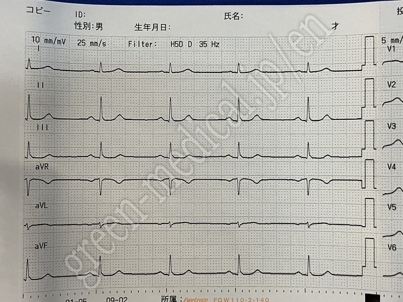 13.〇心電計