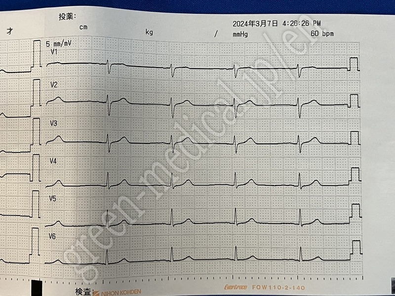 14.〇心電計
