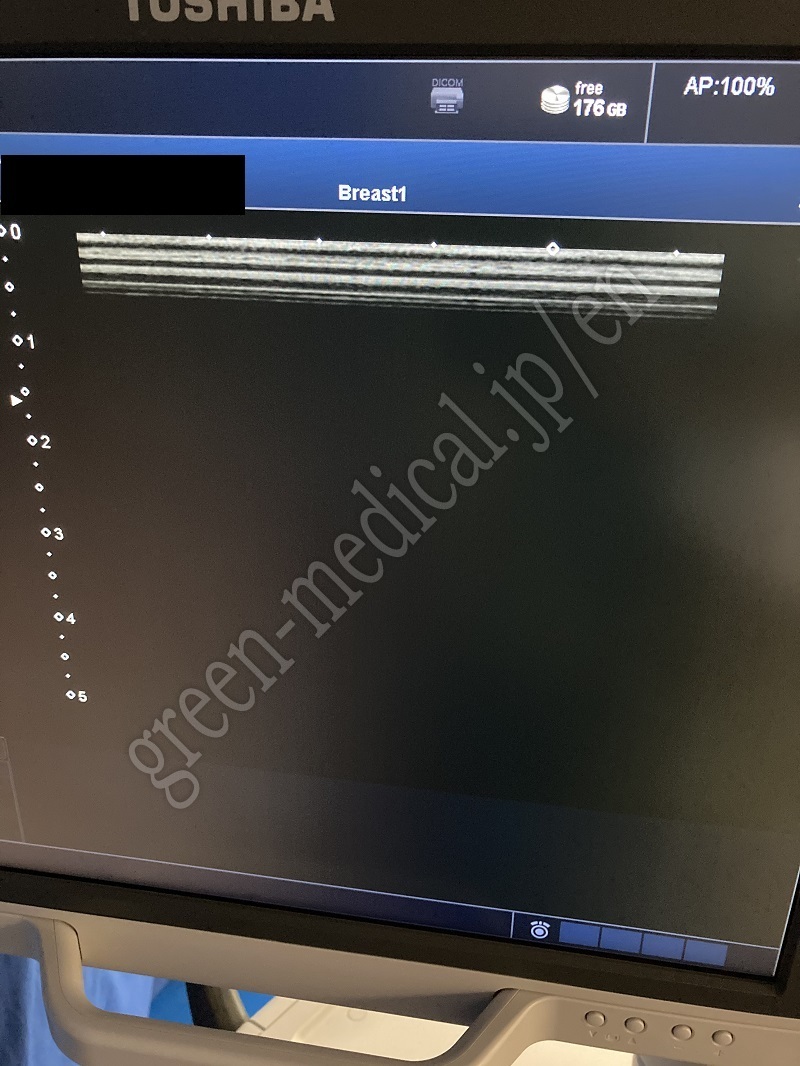 15.超音波診断装置（カラー）