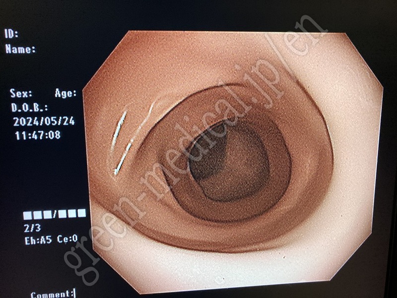 16.○ 大腸ビデオスコープ