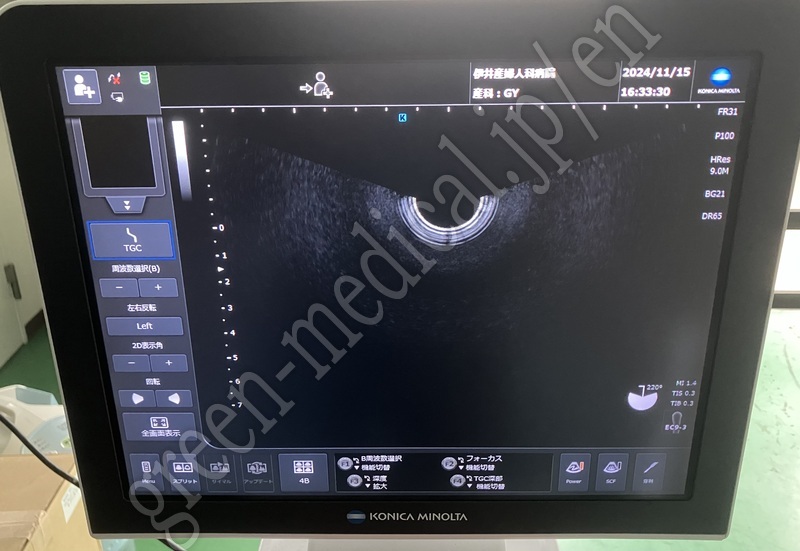 16.○ 超音波診断装置（カラー）