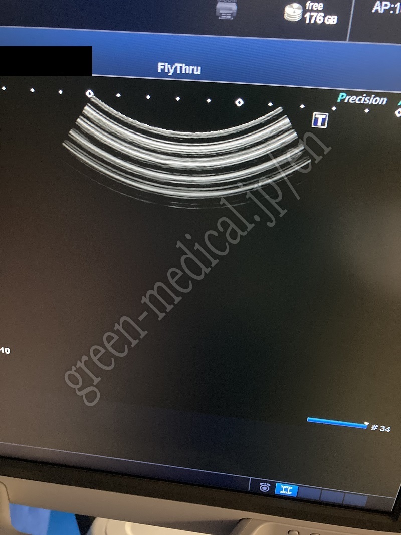 17.超音波診断装置（カラー）