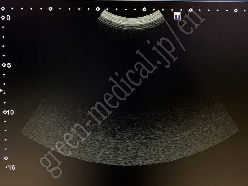 17.〇超音波診断装置