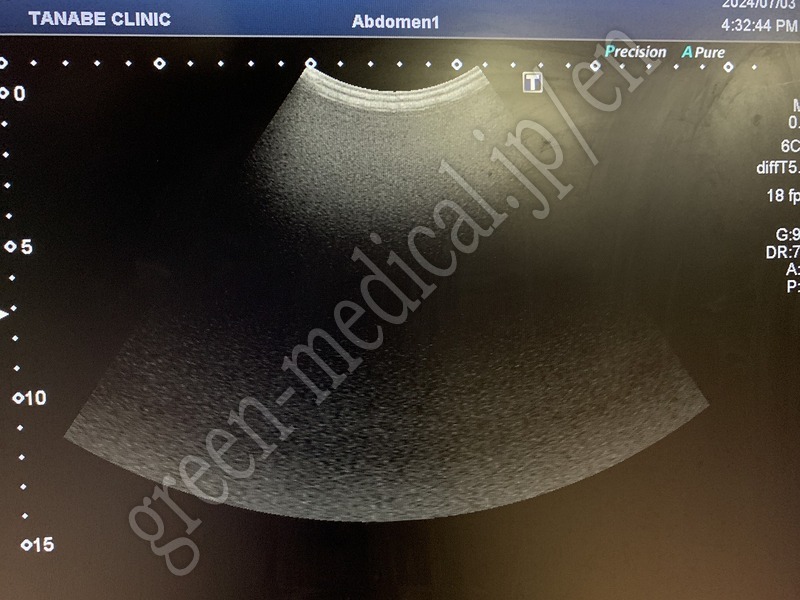 17.超音波診断装置（カラードプラ）