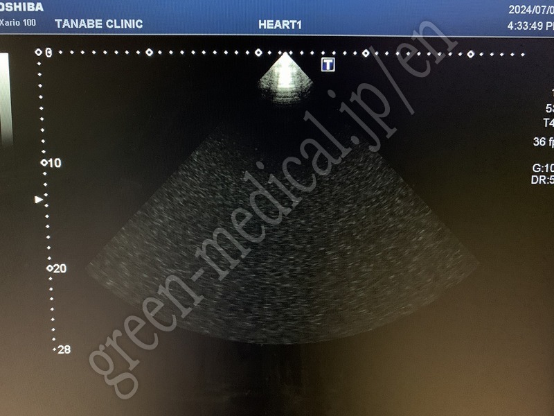 19.超音波診断装置（カラードプラ）