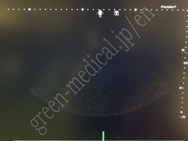 19.〇超音波診断装置