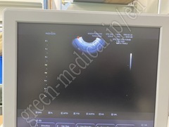 MEDISON Ultrasound Color Doppler