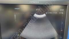 Hitachi Diagnostic  Ultrasound System