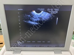 MEDISON Ultrasound Color Doppler