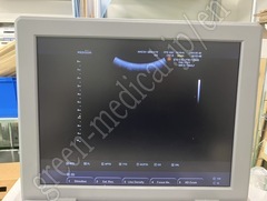 MEDISON Ultrasound Color Doppler