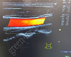 GE Healthcare Diagnostic Ultrasound System