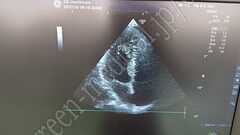 GE Healthcare Diagnostic Ultrasound System