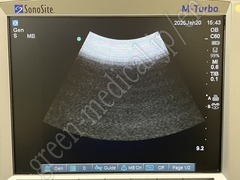 SonoSite Ultrasound Color Doppler