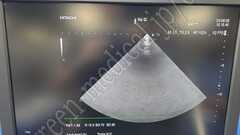 Hitachi Diagnostic  Ultrasound System