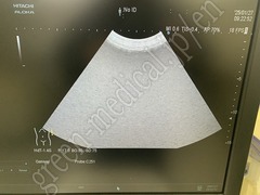 Hitachi Ultrasound Diagnostic System