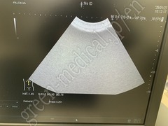 Hitachi Ultrasound Diagnostic System