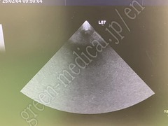 GE Healthcare Ultrasound Color Doppler