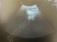 GE Healthcare Diagnostic Ultrasound System