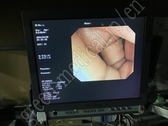 OLYMPUS Video Colonoscope