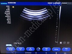 SIEMENS Ultrasound Color Doppler