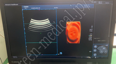 TOSHIBA Diagnostic Ultrasound System