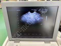 MEDISON Ultrasound Color Doppler