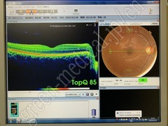 TOPCON 