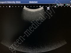 TOSHIBA Ultrasound Color Doppler