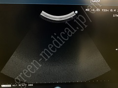 Hitachi Diagnostic Ultrasound Scanner