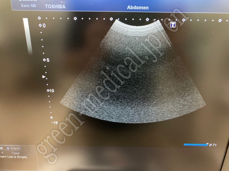 4.超音波診断装置（カラードプラ）