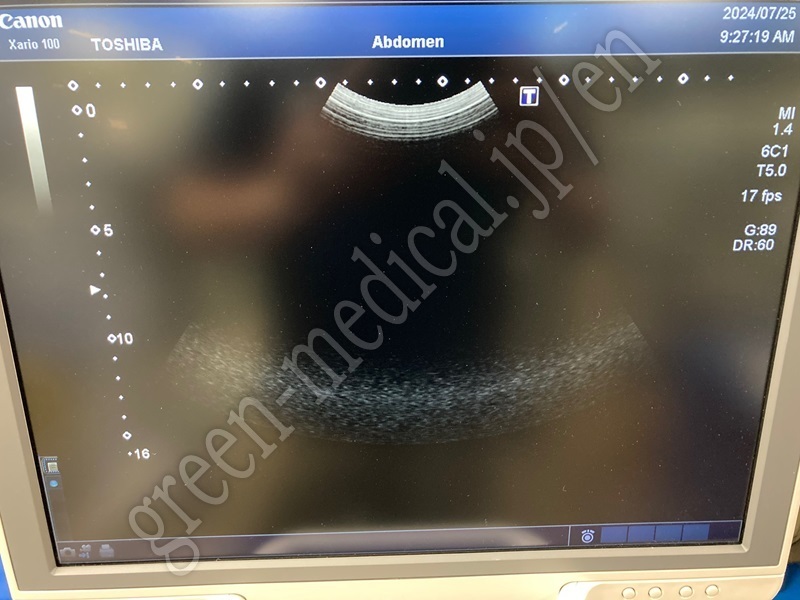5.超音波診断装置(カラー)