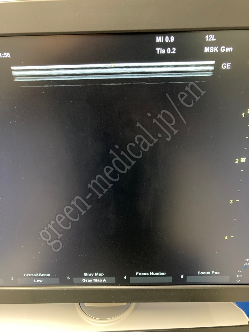 6.〇 超音波診断装置(カラー）