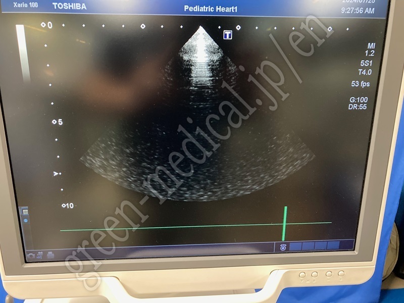 7.超音波診断装置(カラー)