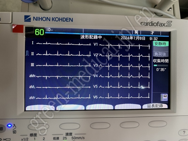 8.解析機能付心電計